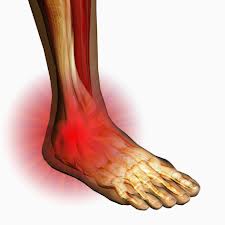 San Diego Chiropractic, Massage help w/ pain relief and treatment of leg  and ankle trouble