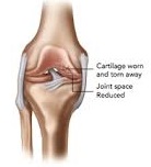 San Diego Chiropractic, Massage help w/ pain relief and treatment of leg and joint trouble