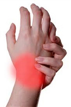 Arm and wrist Pain treatment by San Diego Chiropractic and Massage